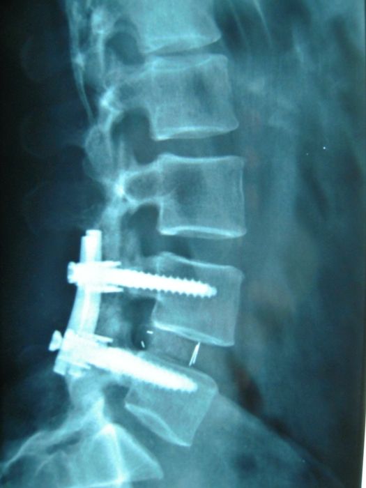 Federico Longhitano-3