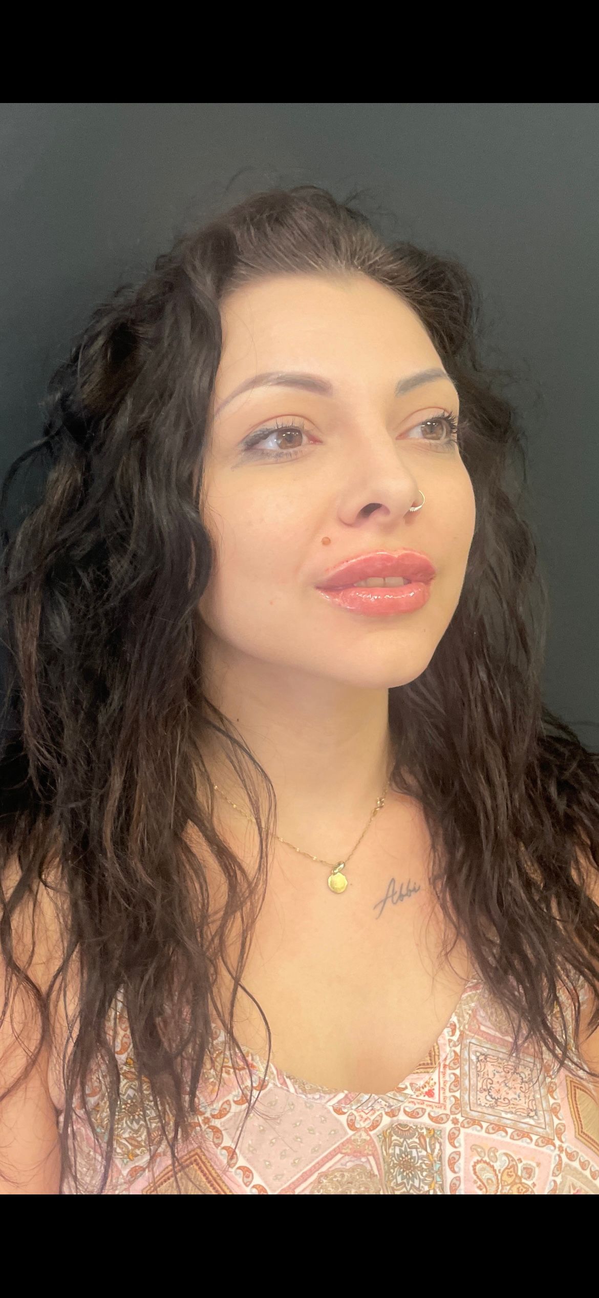 Alberto Alessandri-14