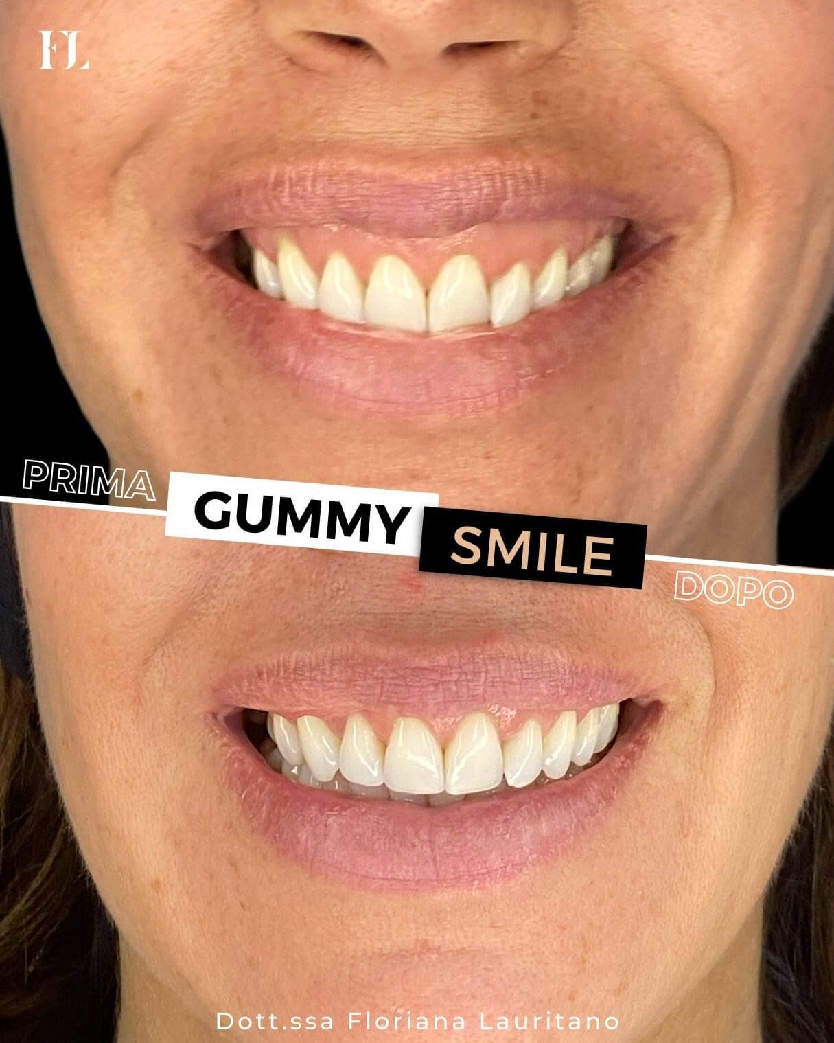 Floriana Lauritano-35