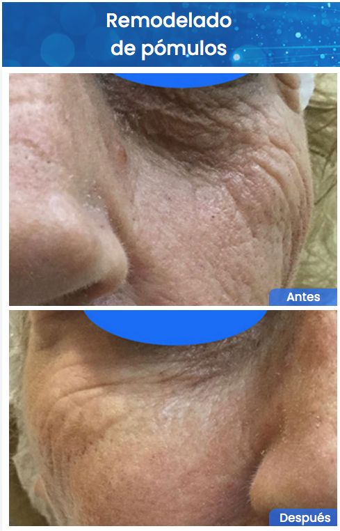 Juan Enrique Pérez Enríquez-136