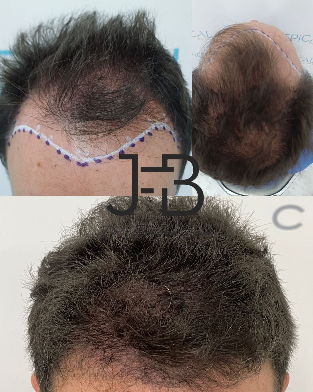 Juan Francisco Belén Montero-12