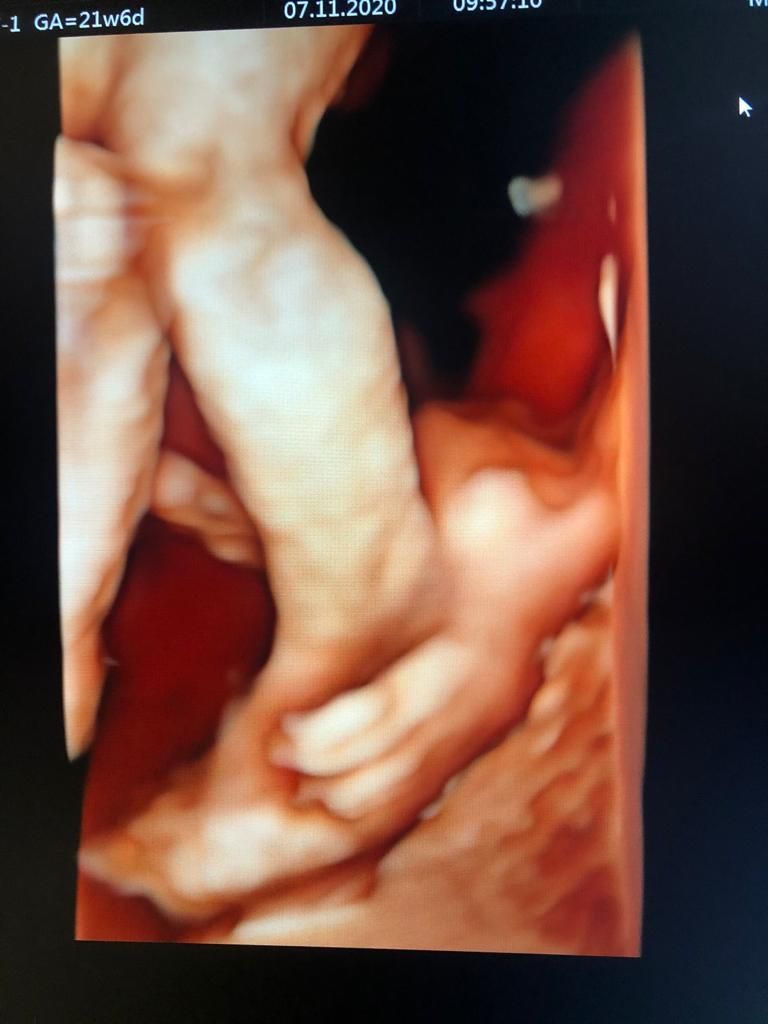 Dilek Turğut Kestane-17