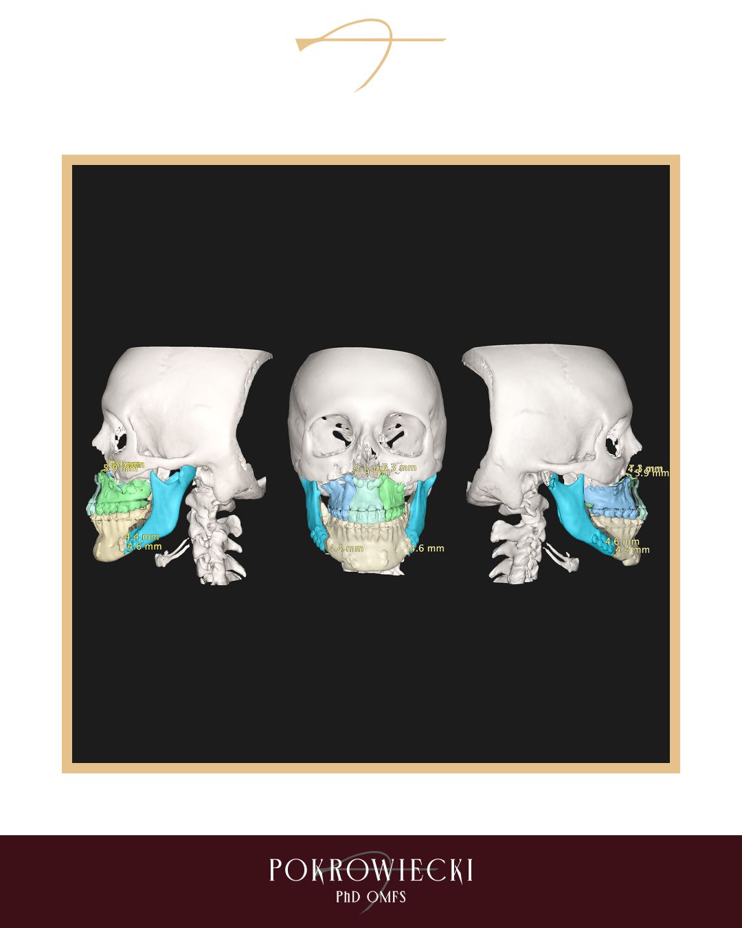 Rafał Pokrowiecki-47