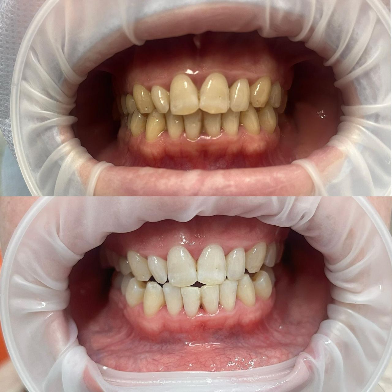 Viktoriia Dikhtiarenko-10