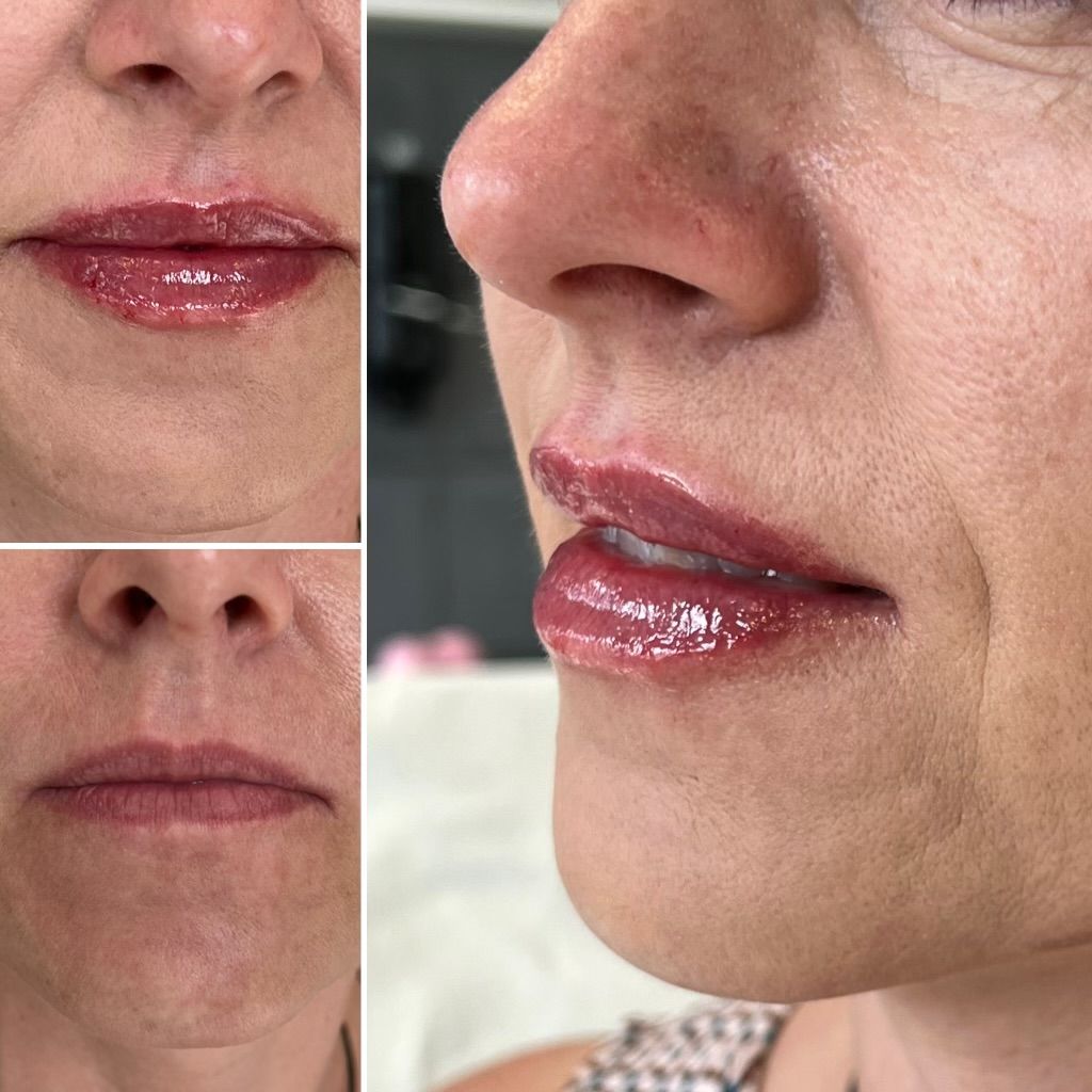 Dominika Kunysz-Schwermer-6