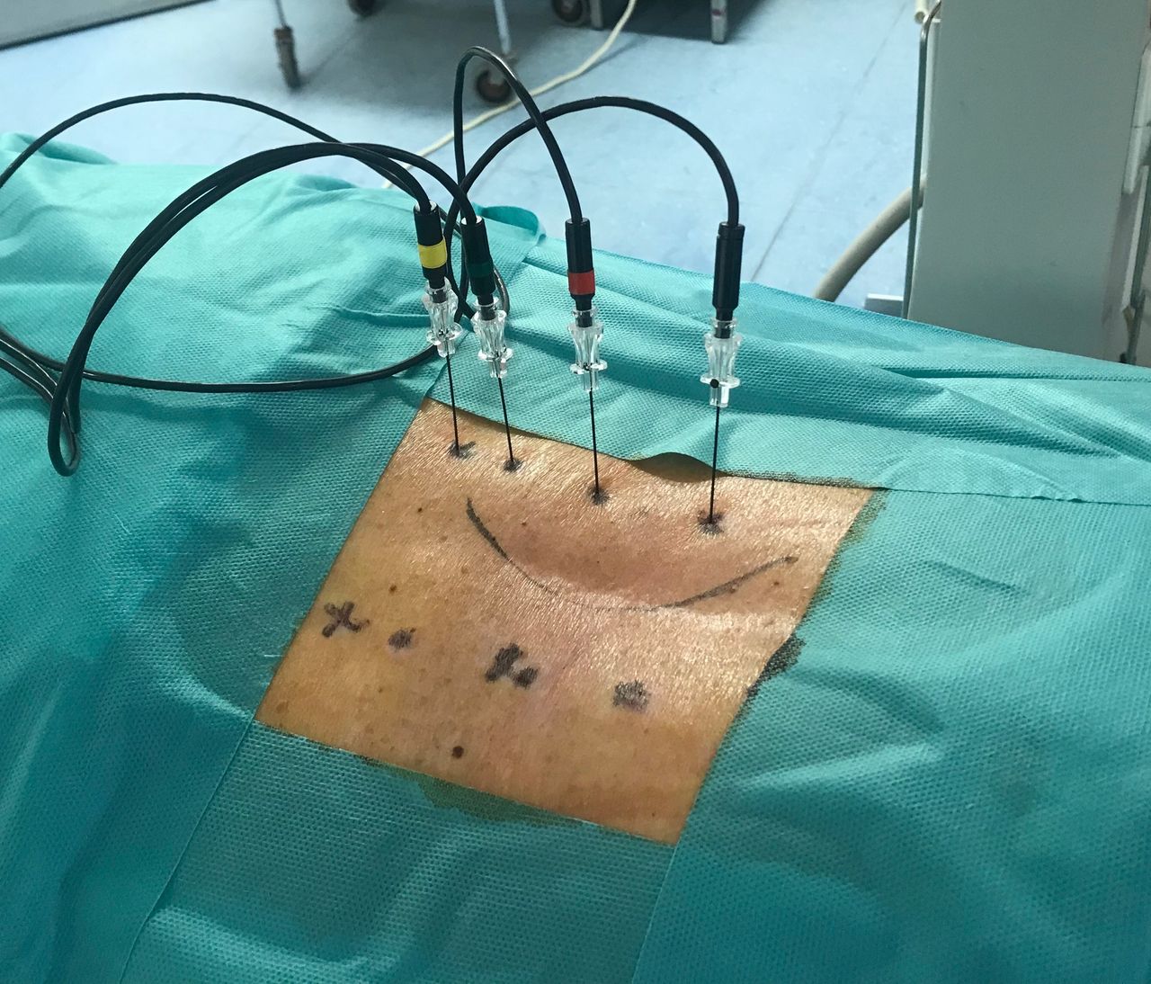 Juan Camilo Hernandez Acevedo-22