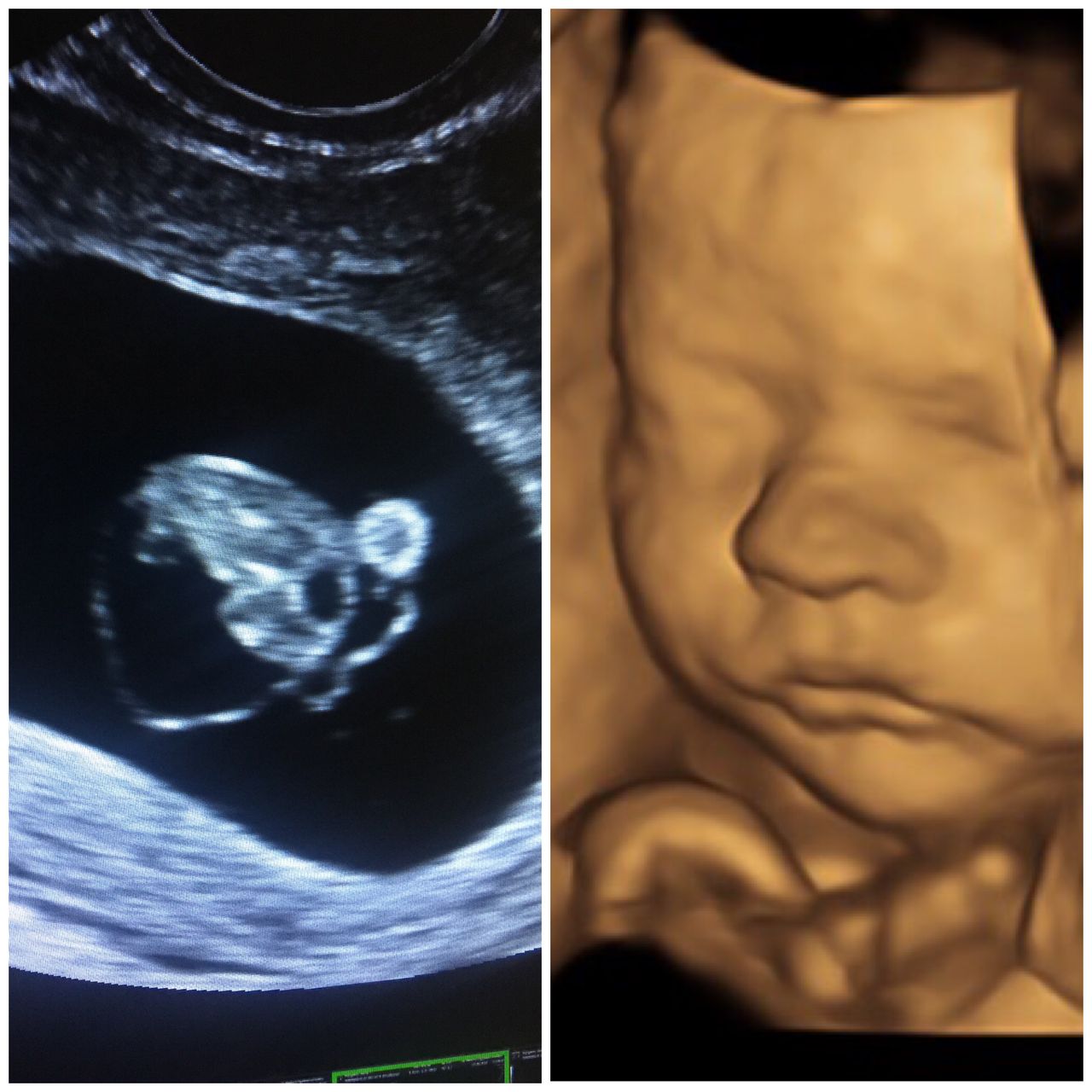 Maksymilian Kurkowski-1