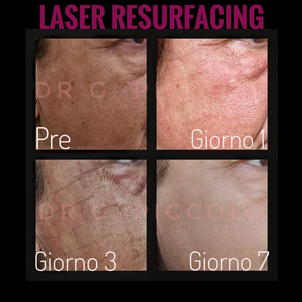 Giuseppina Piccolo-52