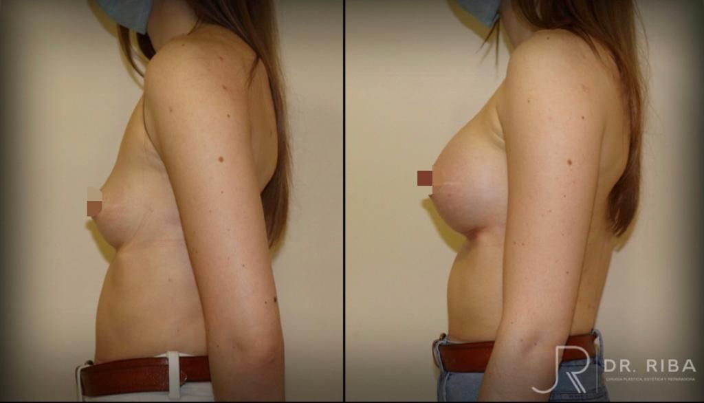 Jordi Riba Vilchez-55