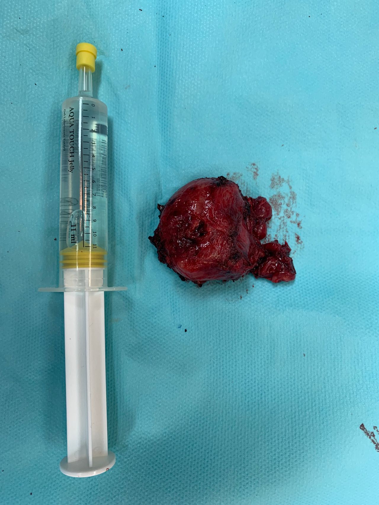 Luis Fernando Susaníbar Napurí-9