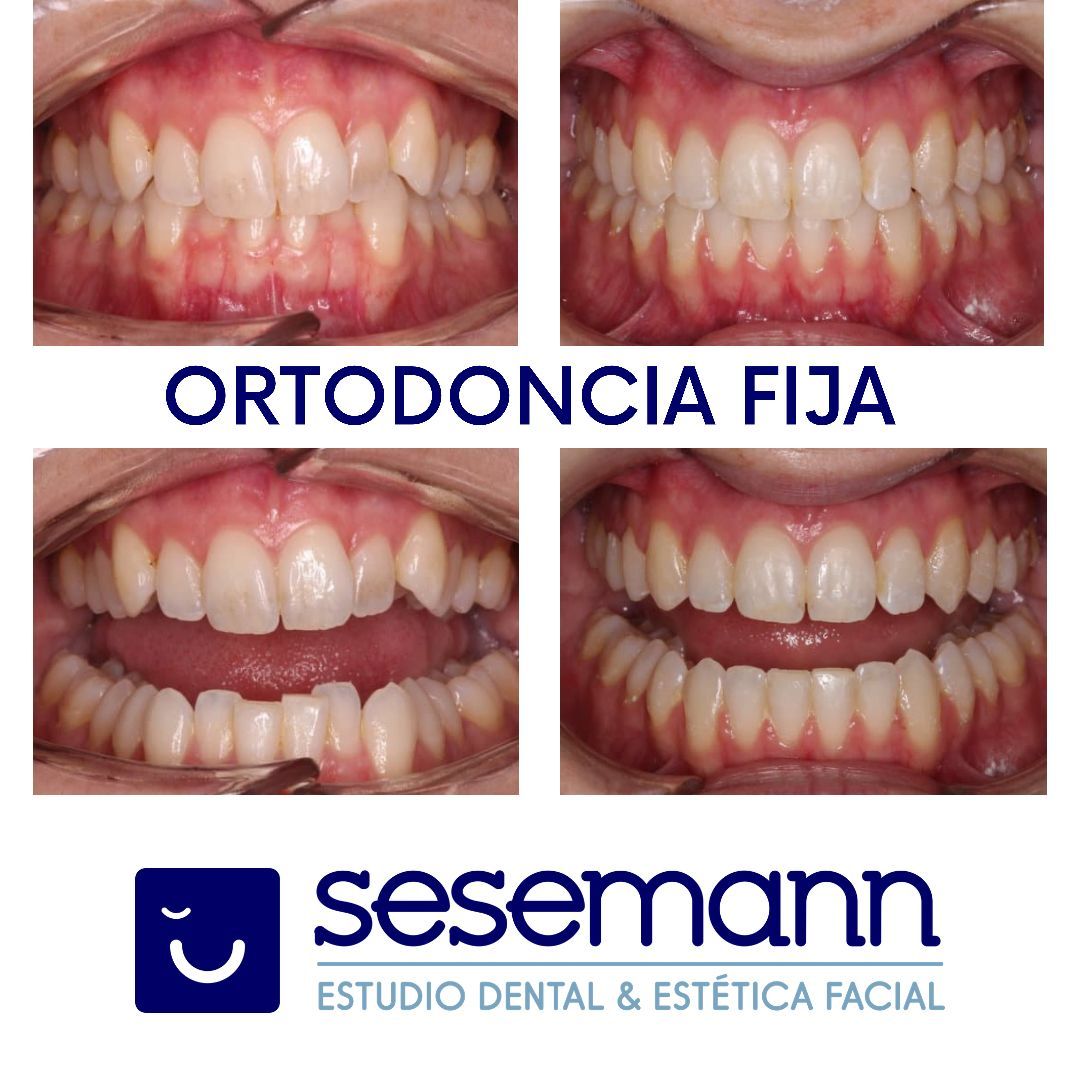 Paula Cano Carrillo-95