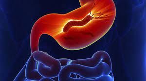 Jose Francisco Juanmartiñena-8