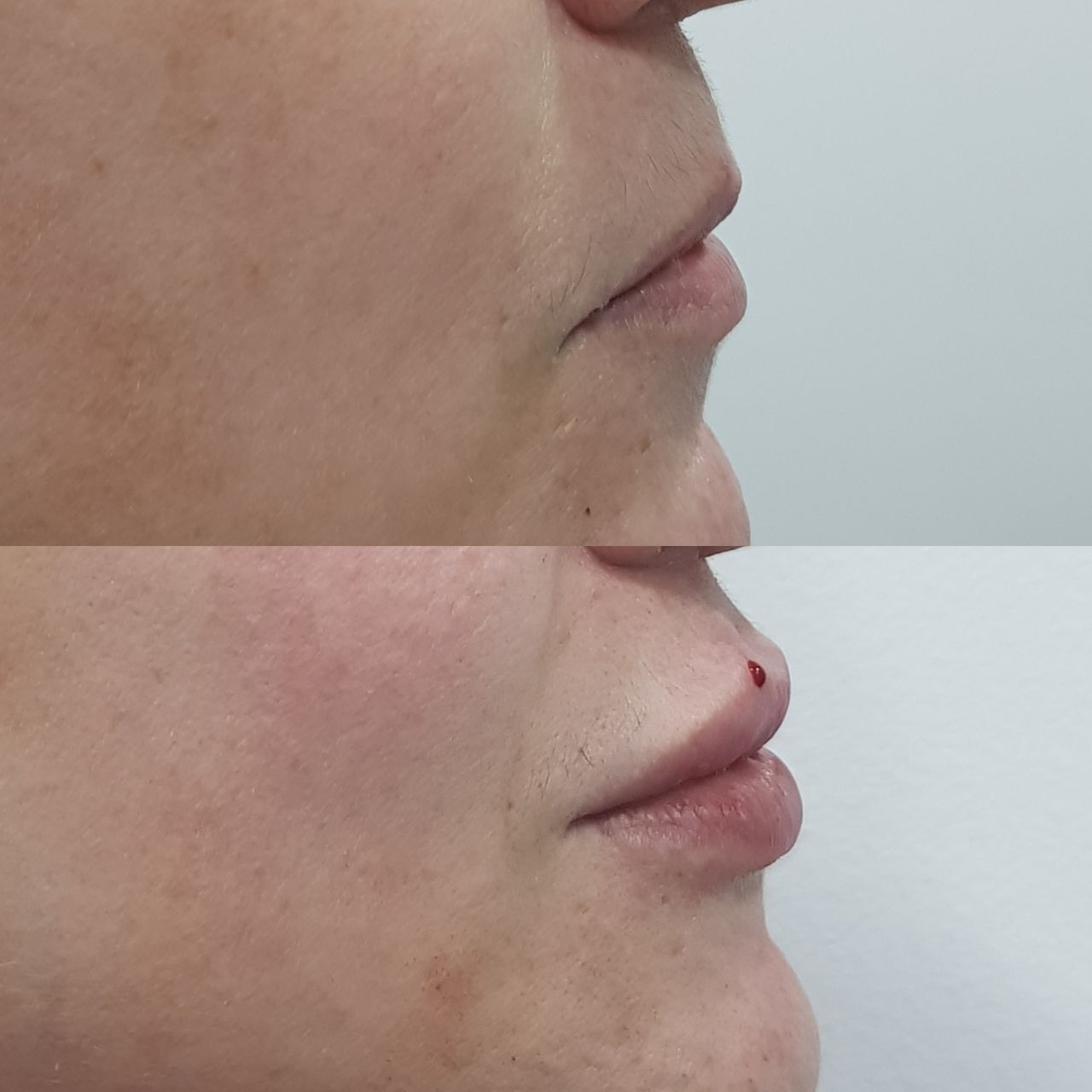 Rosalba Herrero Zerpa-236