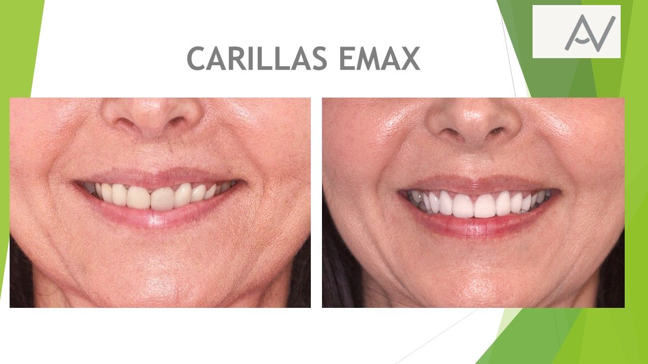 Antonia Aviles Lopez-5