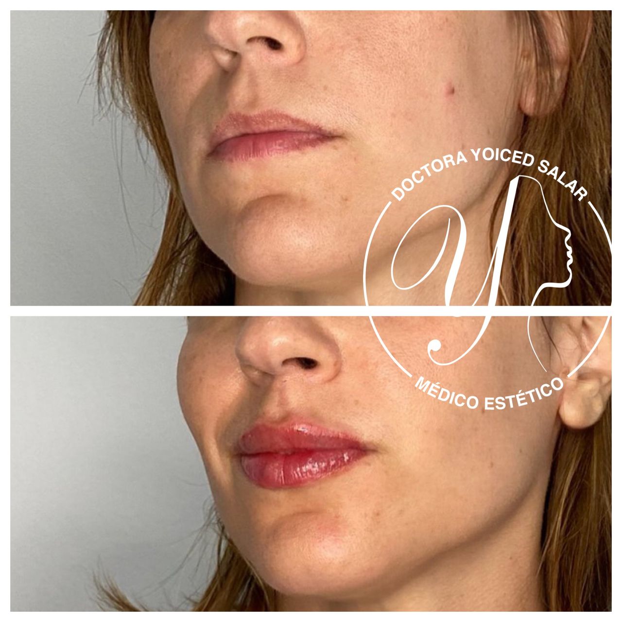 Yoiced Salar Peñate-24