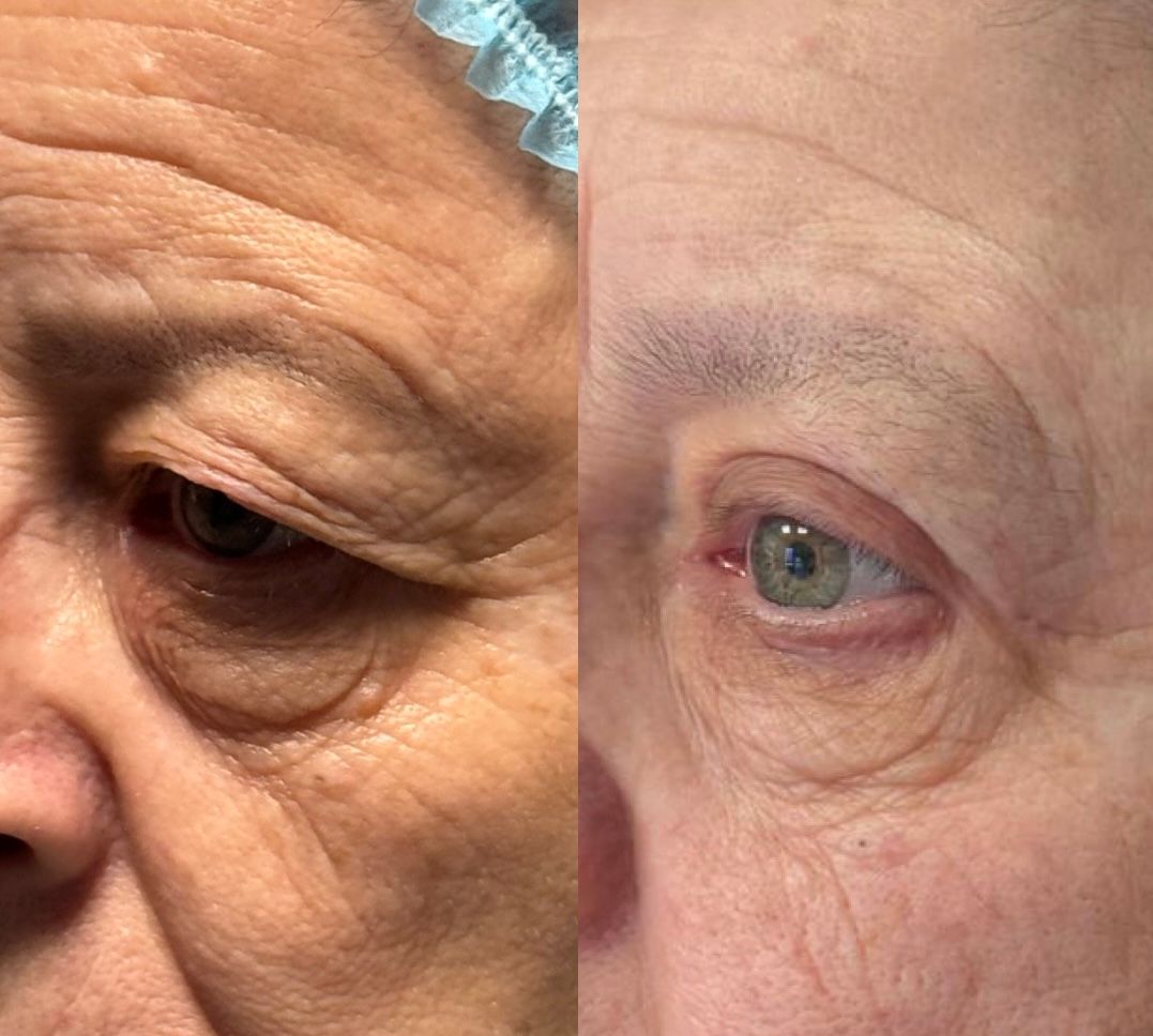 Pier Paolo Ferretti-3