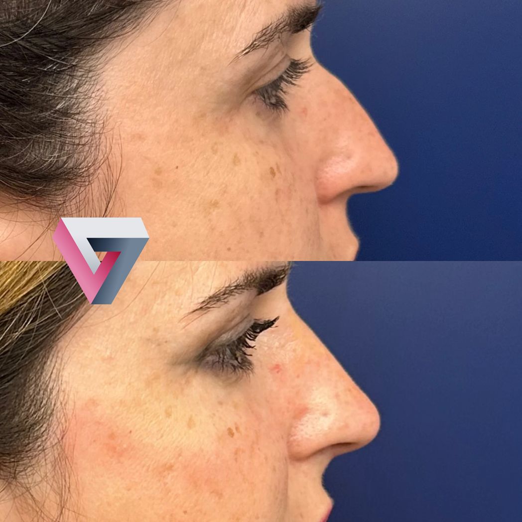 Victoria Trasmonte-95