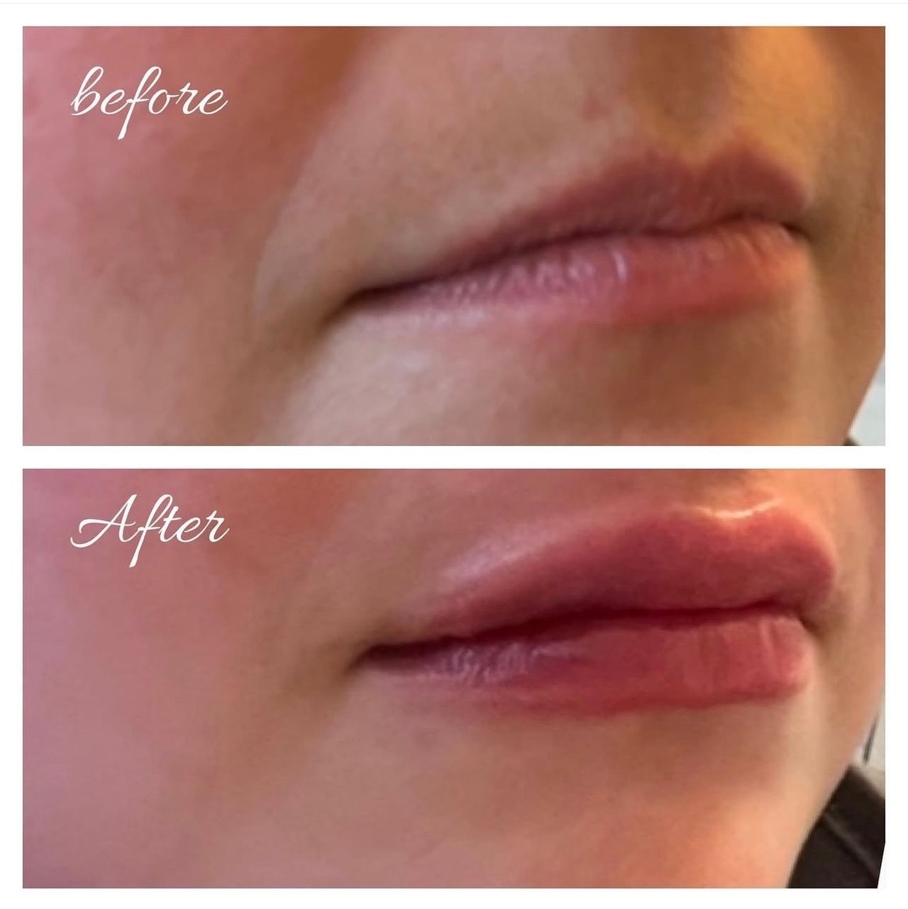 Milo Rafael Timraz-0