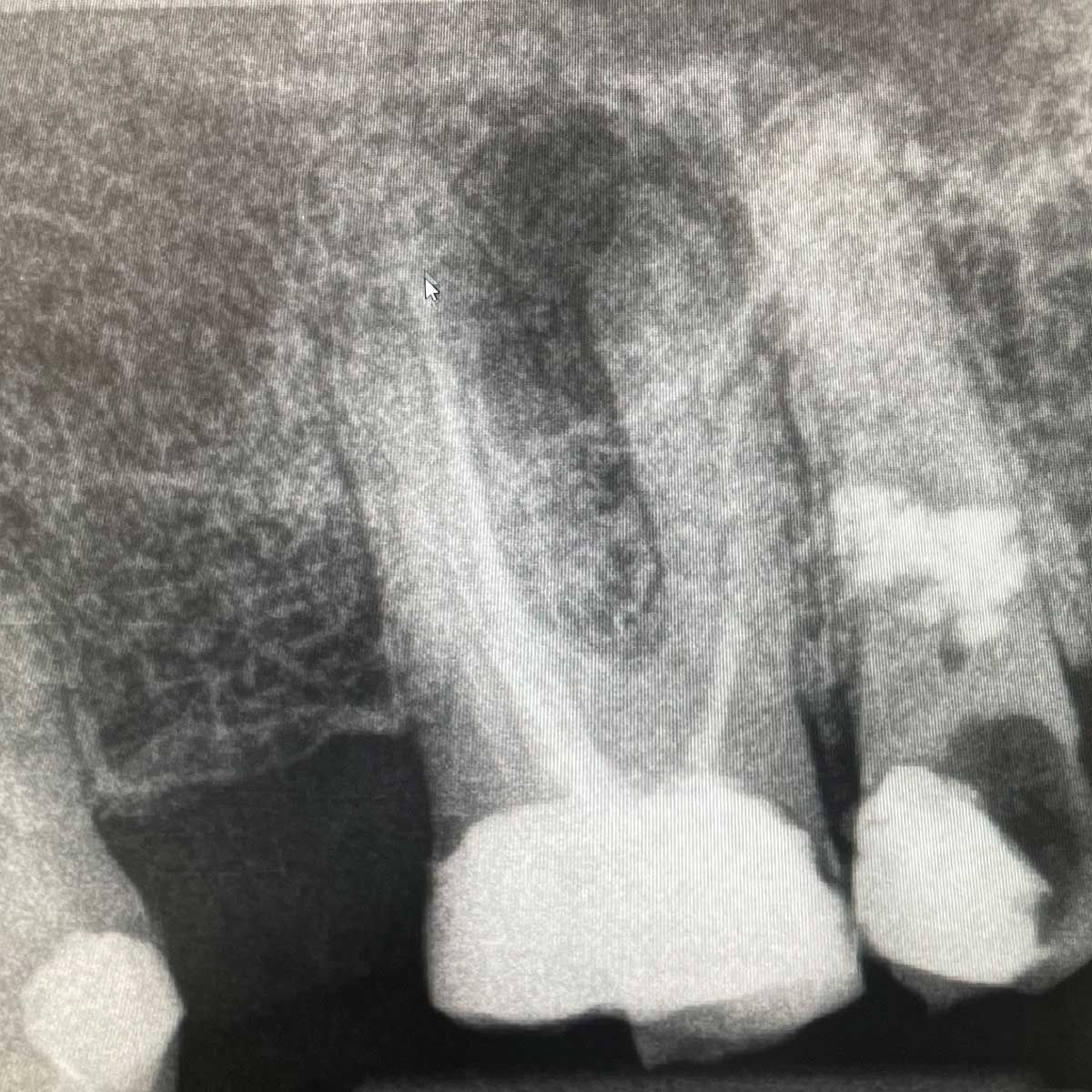 Gianluigi Bittante-80