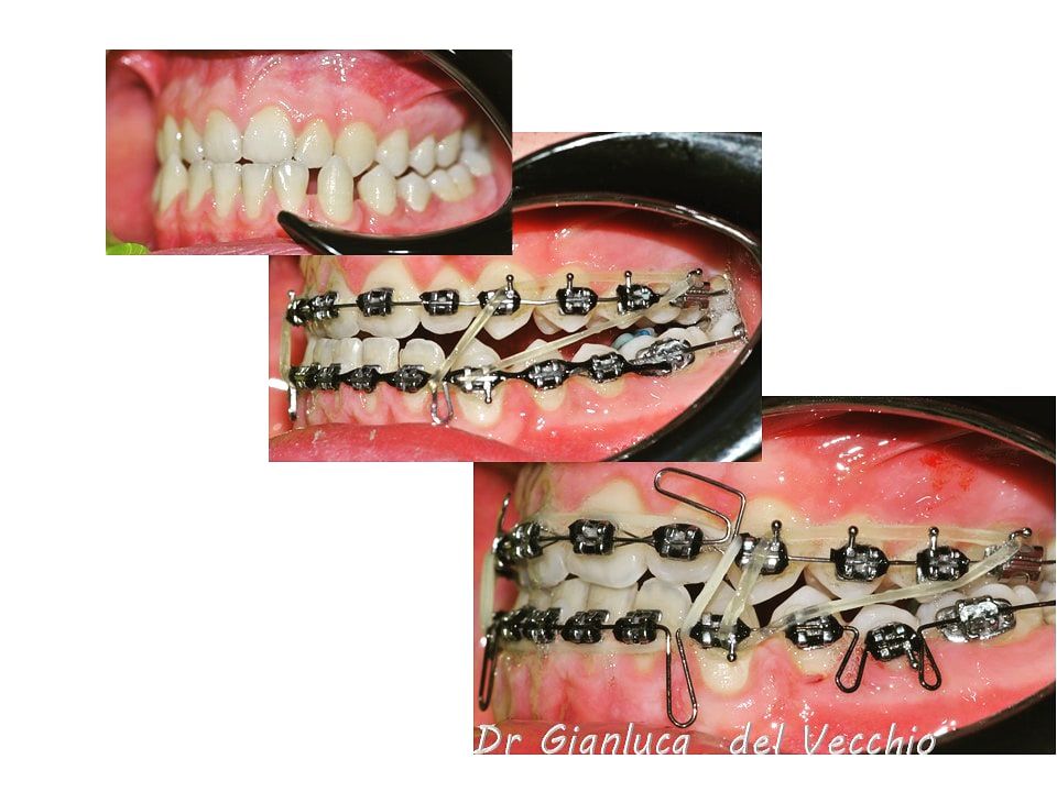 Gianluca Del Vecchio-89