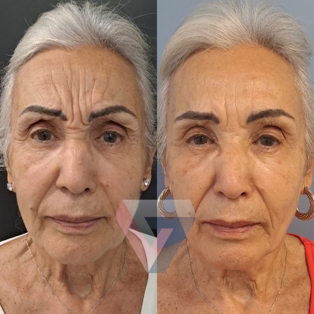 Victoria Trasmonte-123