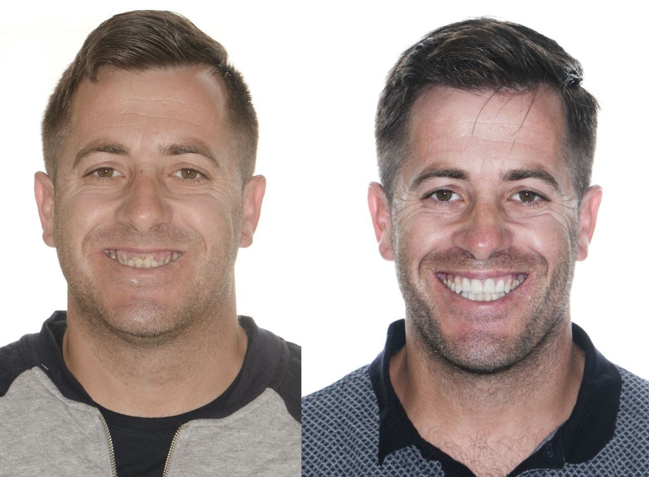 Federico Hernández Alfaro-3