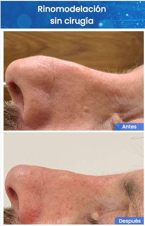 Juan Enrique Pérez Enríquez-137