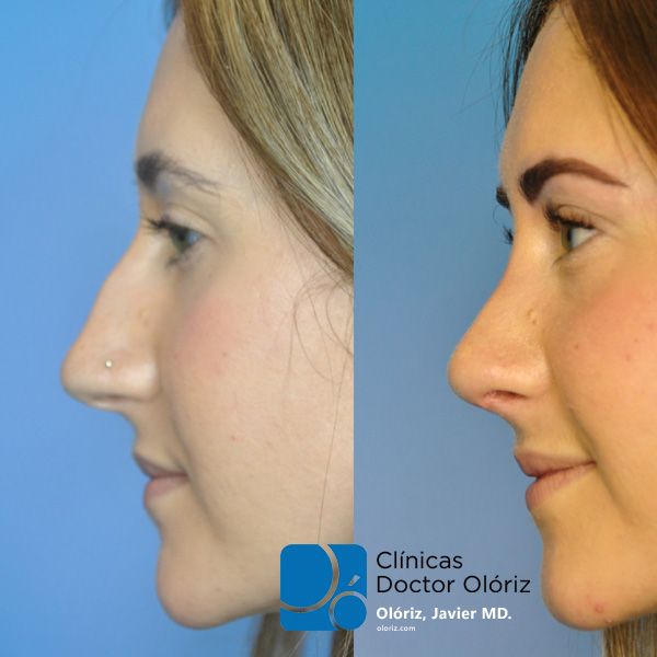 Javier Oloriz Marin-14