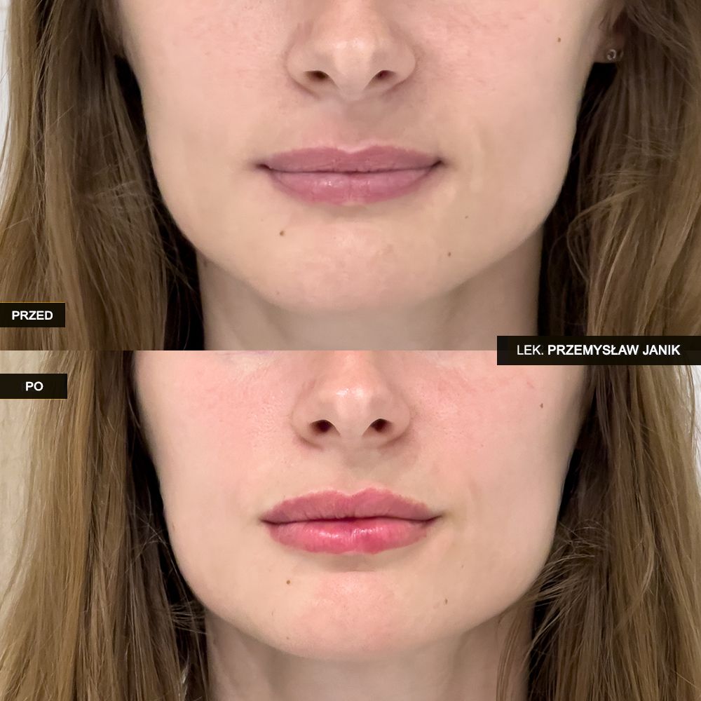 Przemysław Janik-49