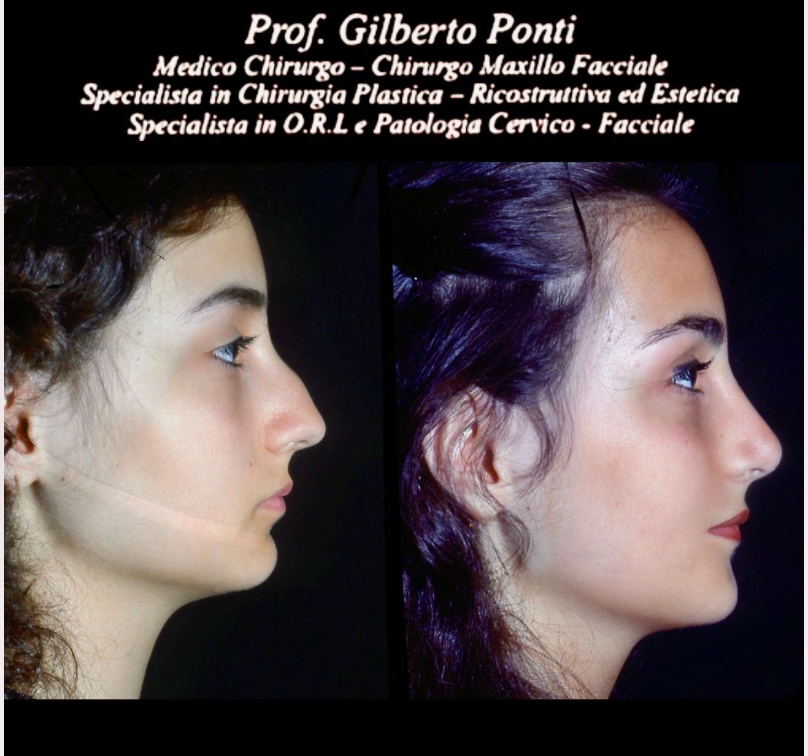 Gilberto Ponti-54