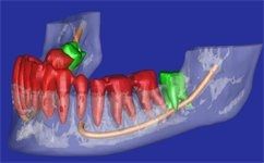 Alessandro Palumbo-4