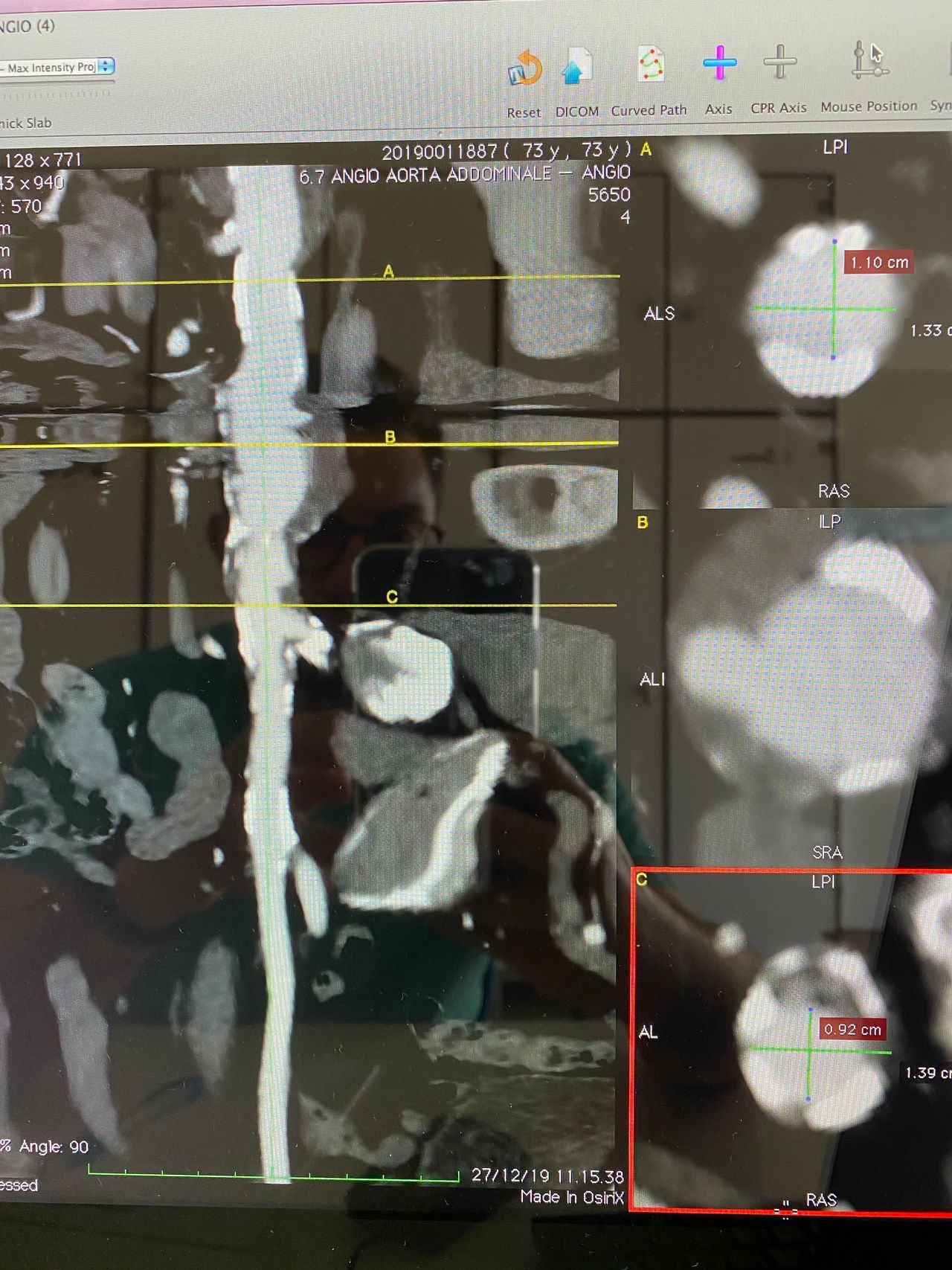 Giovanni Mastrangelo-1