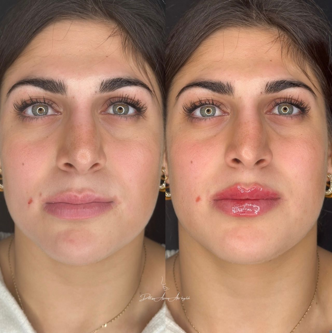 Assmaà Abu Higileh-4