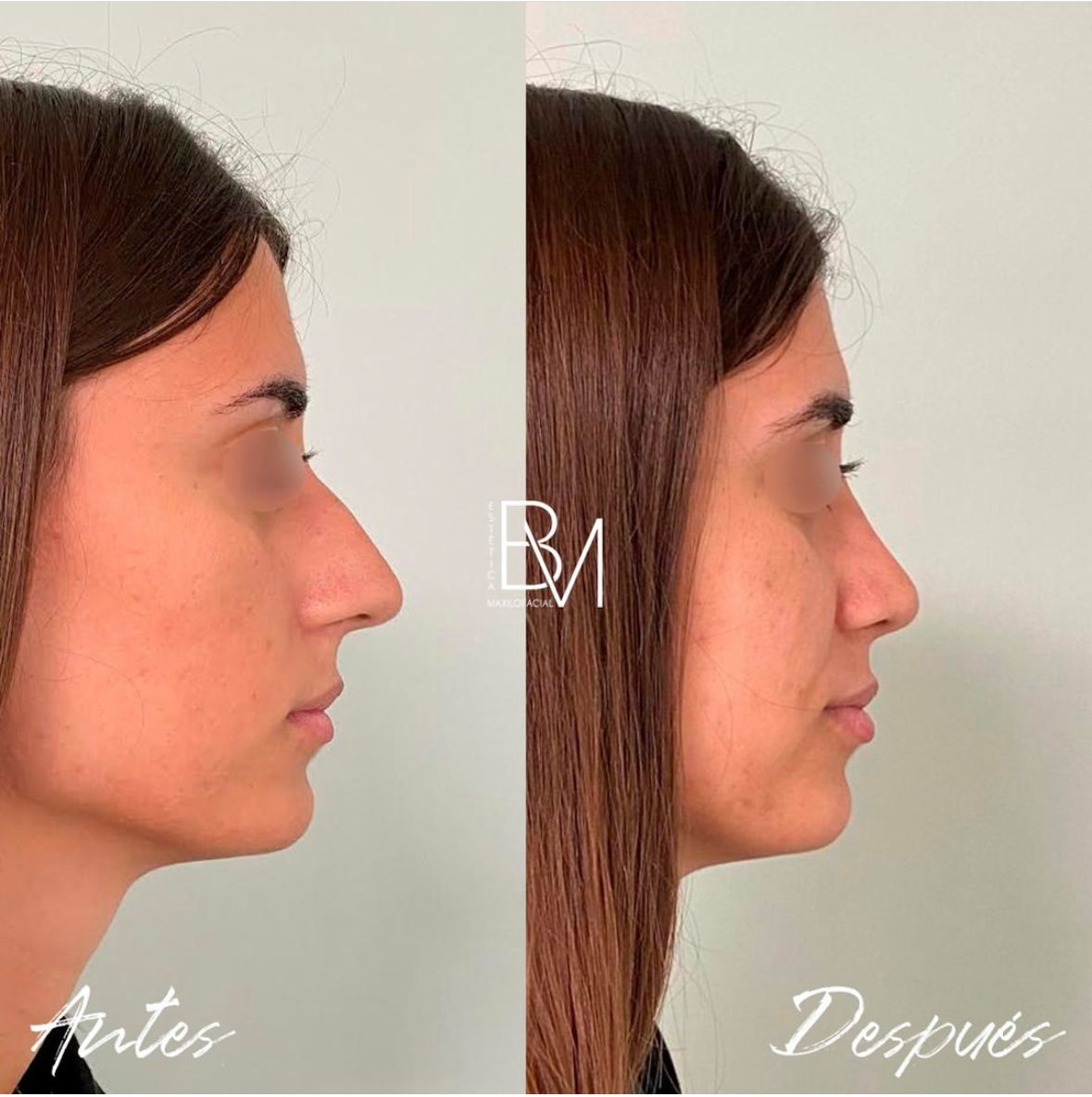 Beatriz Moralejo-71