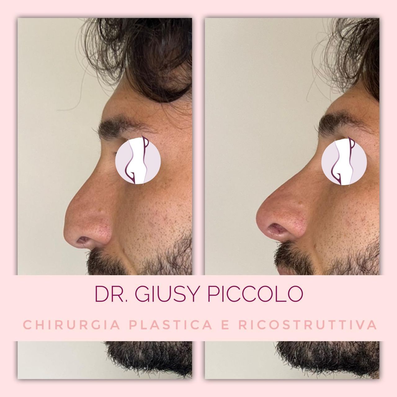 Giuseppina Piccolo-12