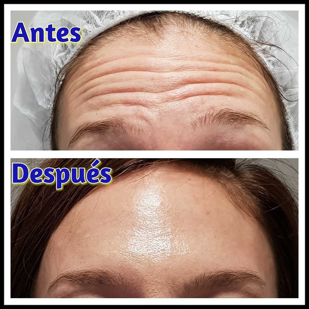 Rosalba Herrero Zerpa-398