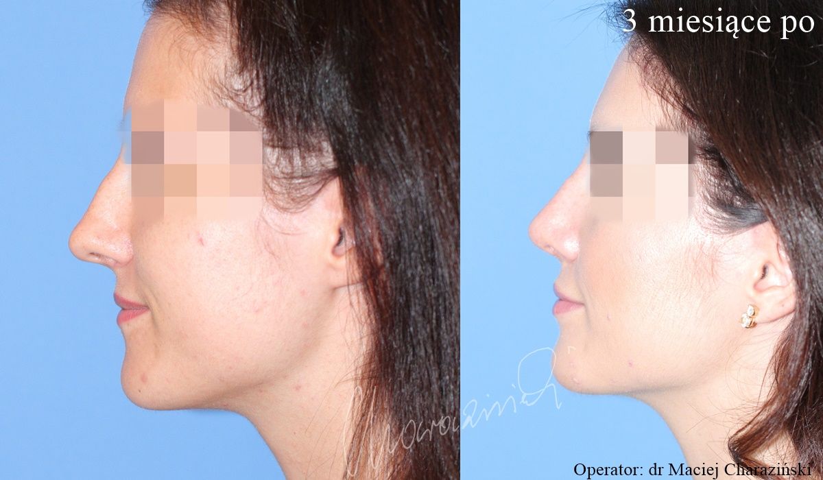 Maciej Charaziński-57