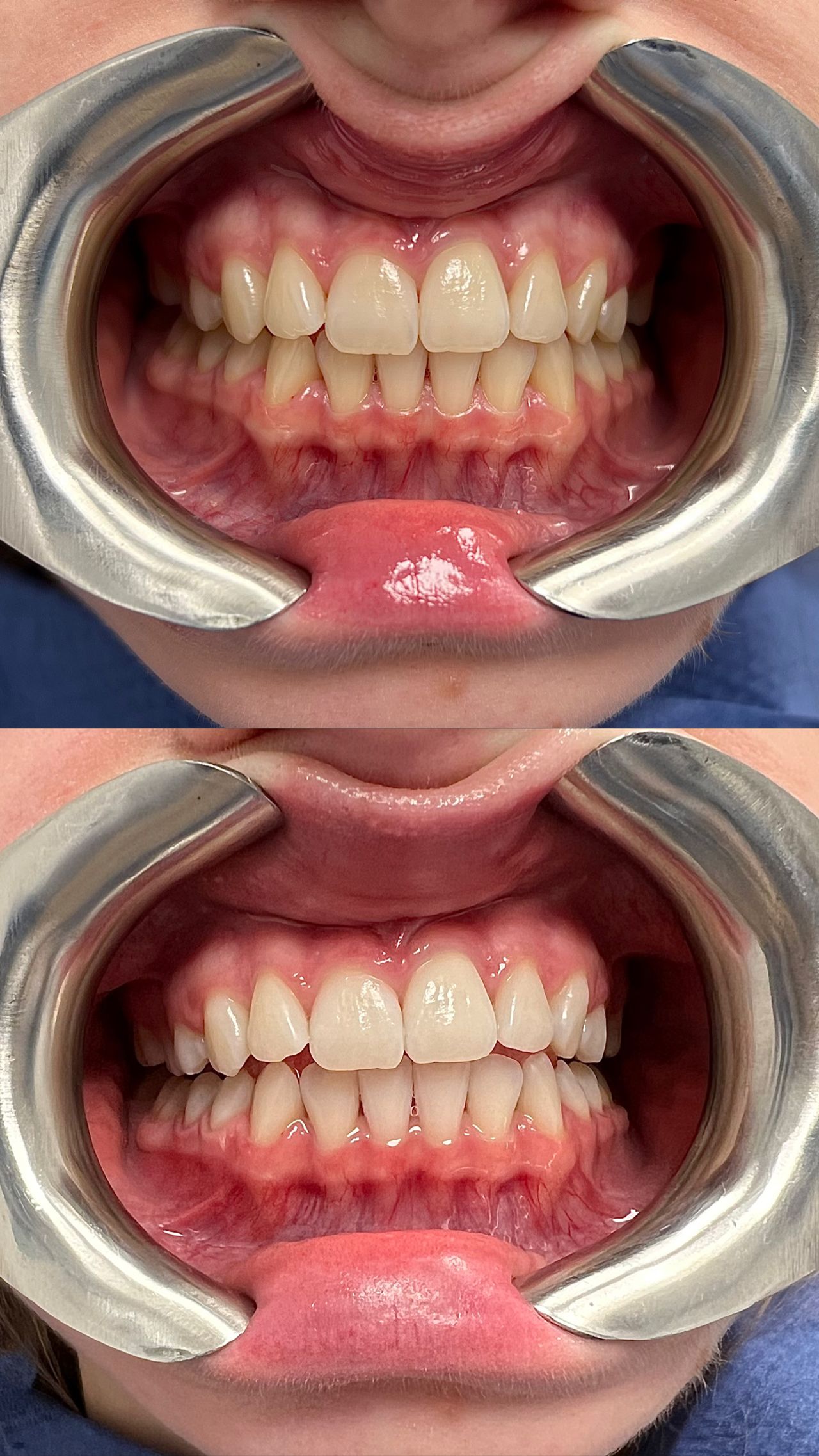 Oleksandra Chernykh-20