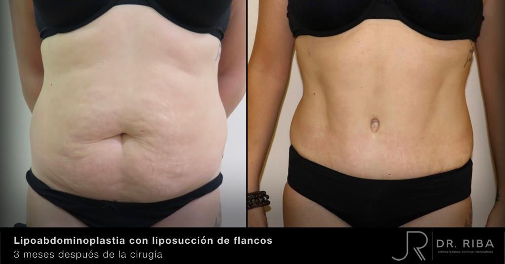 Jordi Riba Vilchez-32