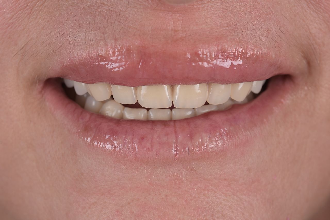 Riccardo Giardina-60