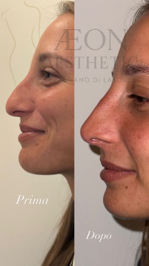 Sebastiano Di Lascio-9