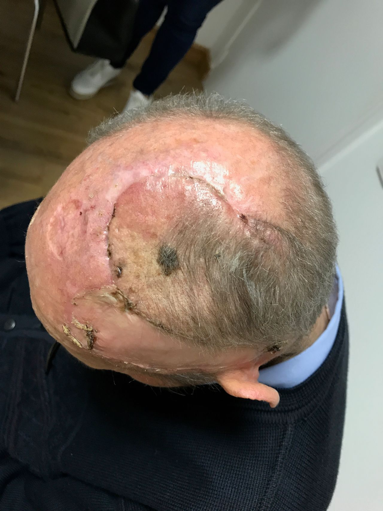 Juan Camilo Hernandez Acevedo-45