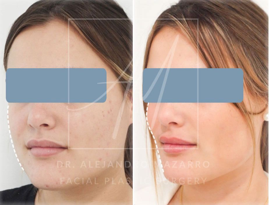 Alejandro Mazarro Campos-5