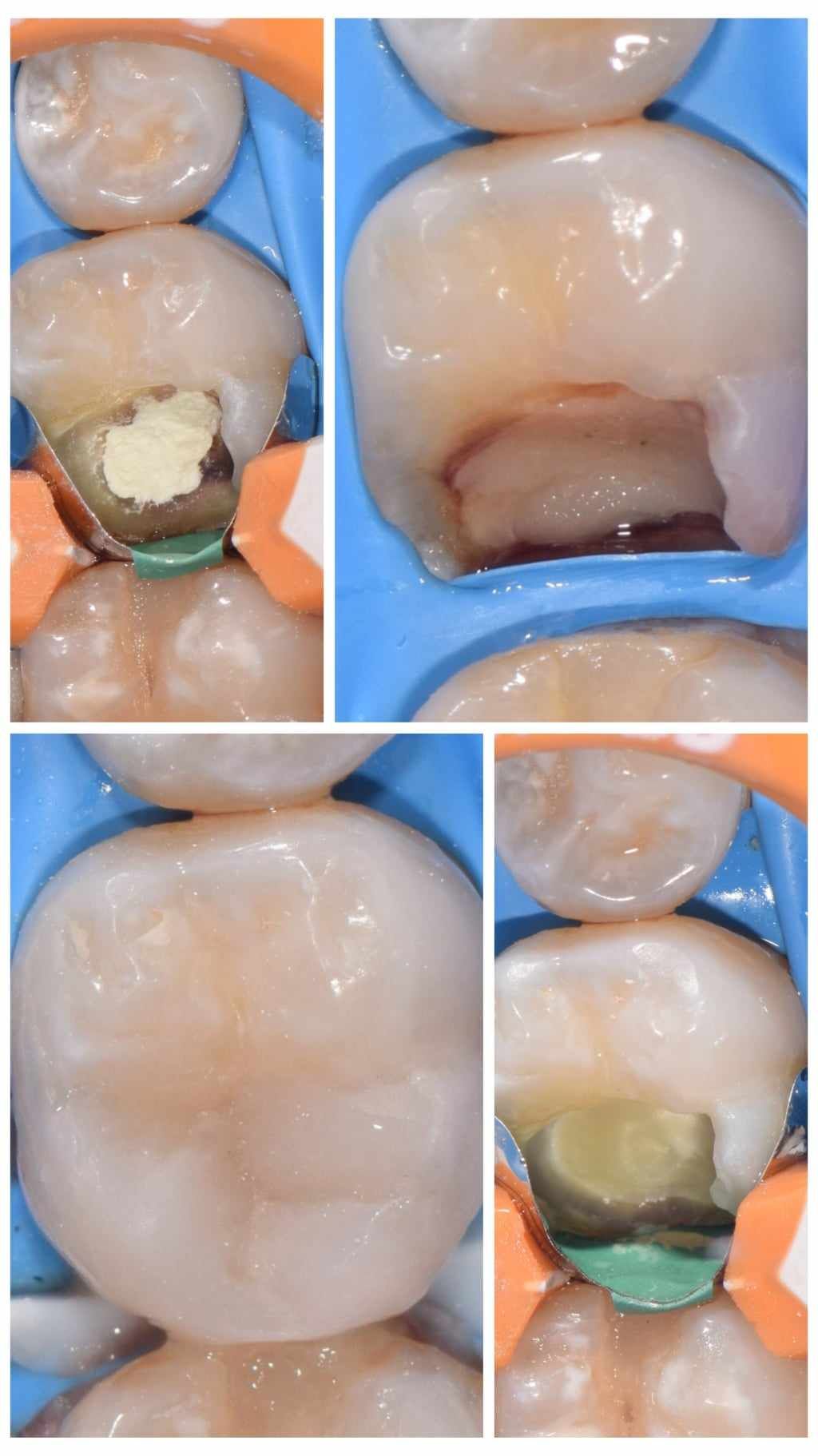 Damian Benbenkowski-1