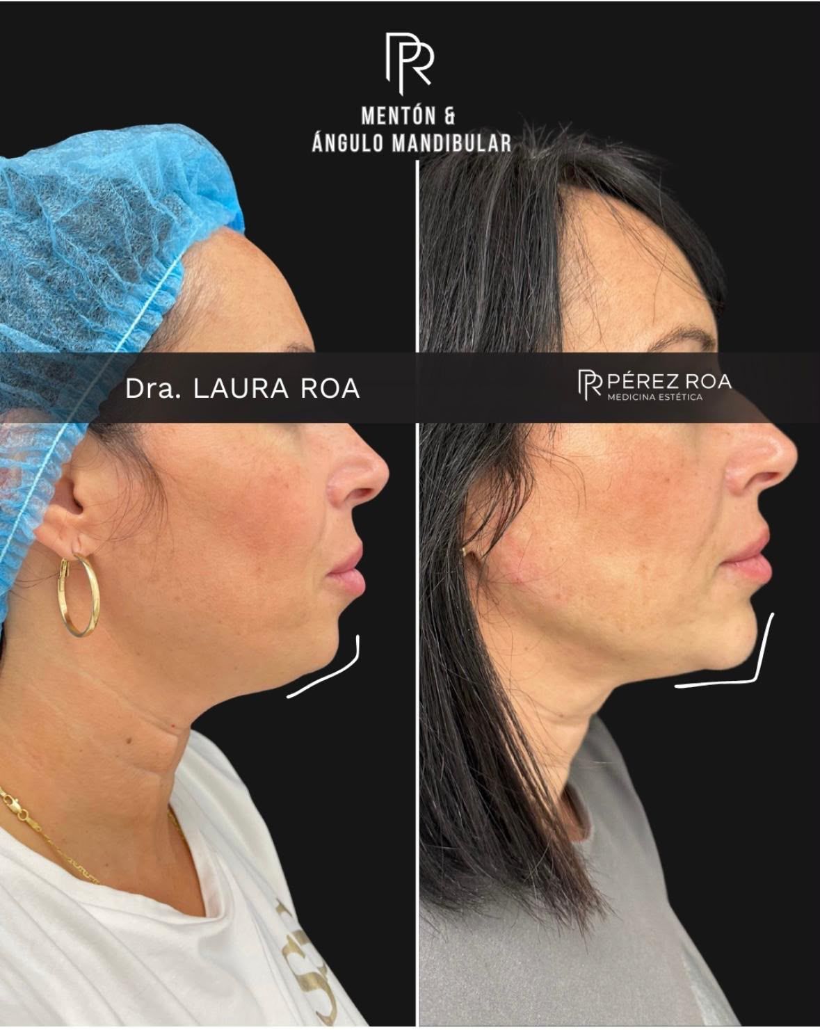 Laura Roa Fernandez-20