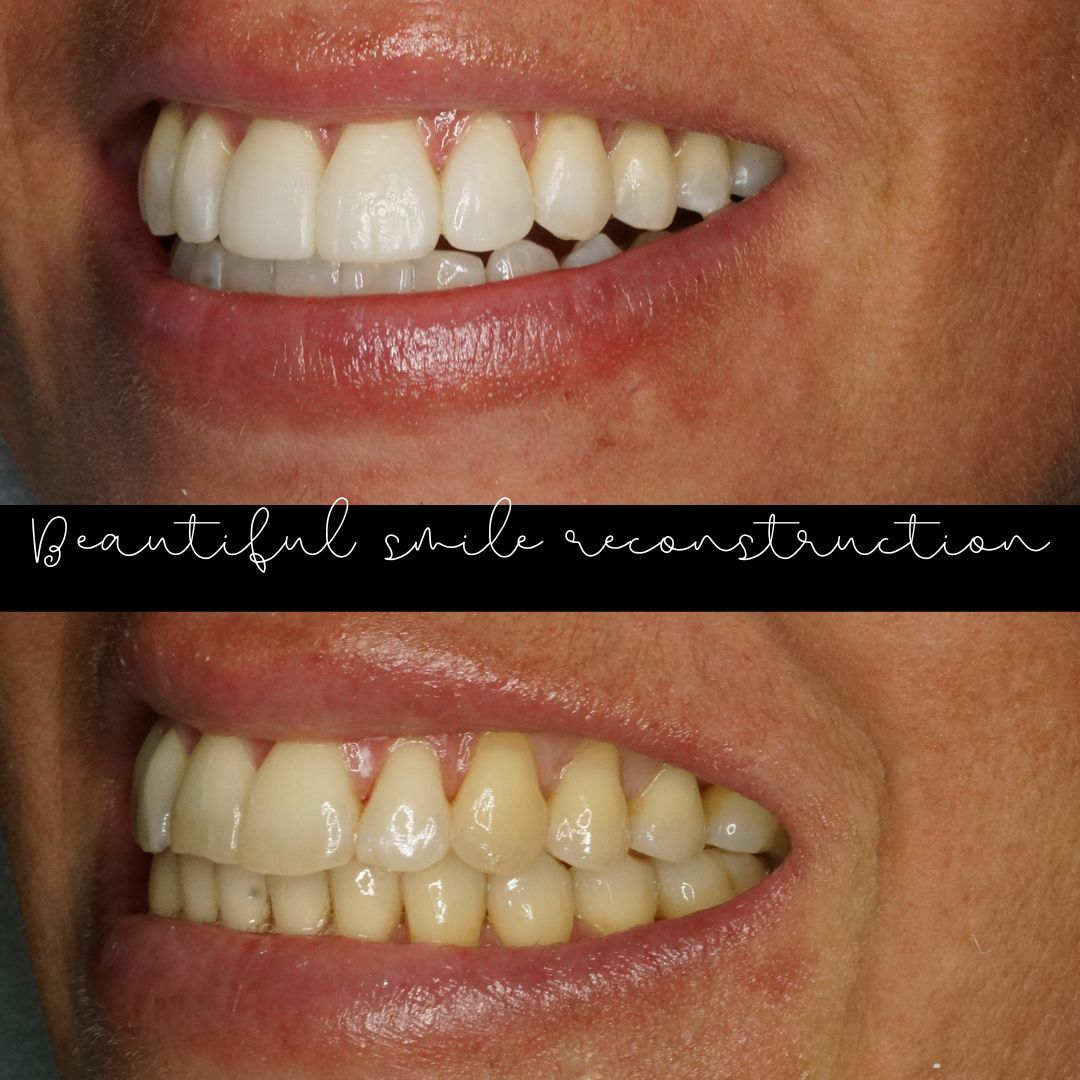 Raimonda Bogdanoviciute-24