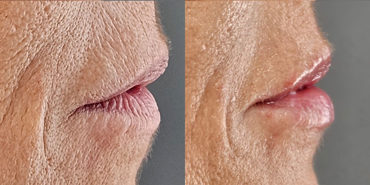 Rosalba Herrero Zerpa-28