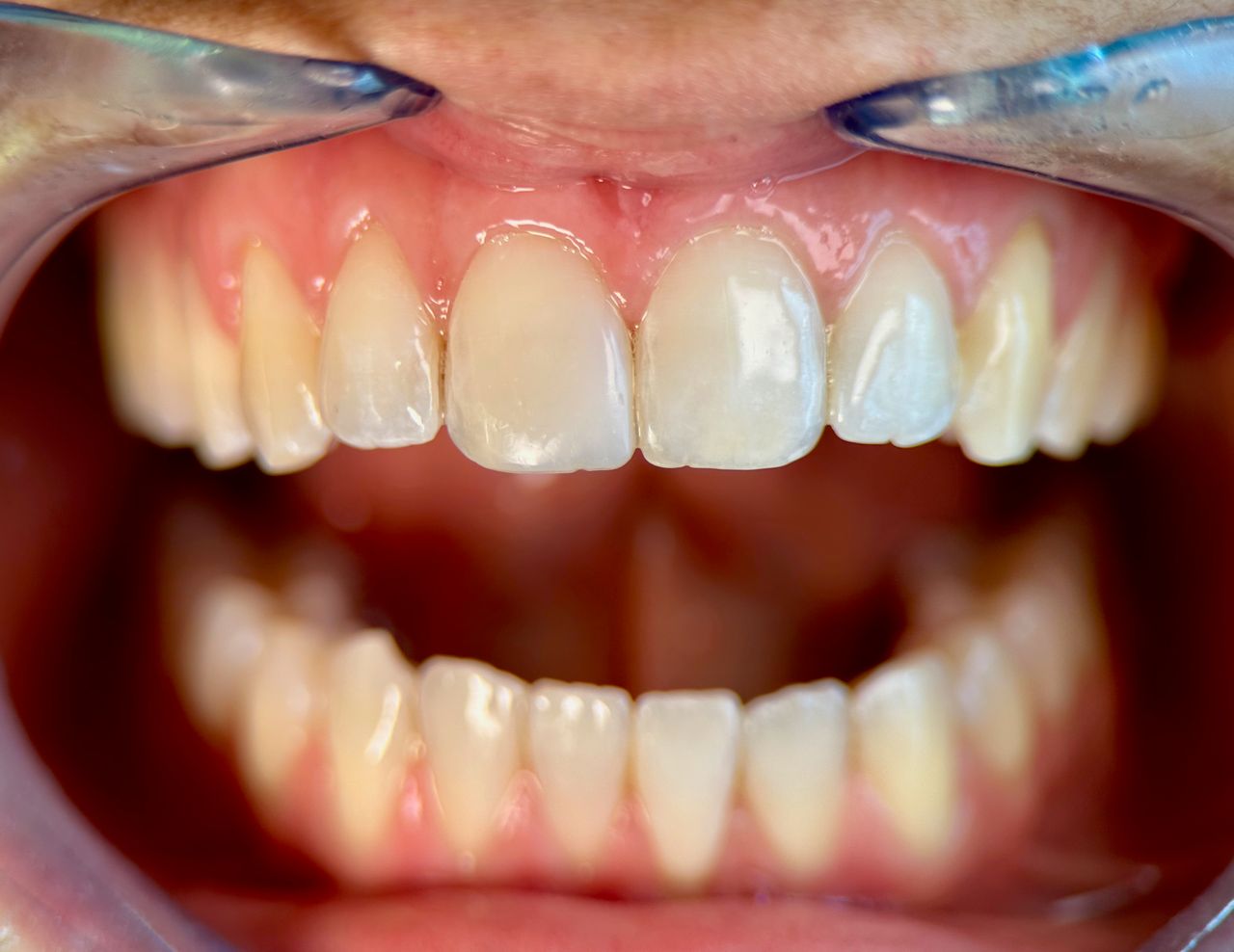 Alberto Bortoletti-3