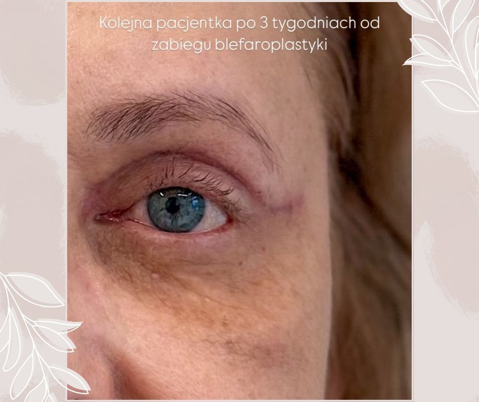 Piotr Florczuk-Dąbek-2