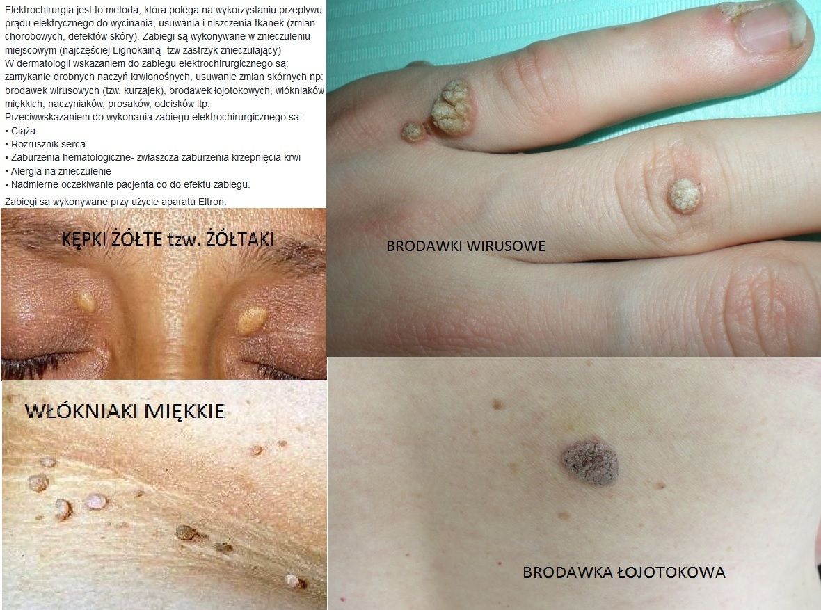 Zbigniew Pietrzak-16